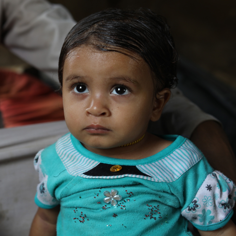 In Yemen, a young gil recovering from malnutrition sits with her father.