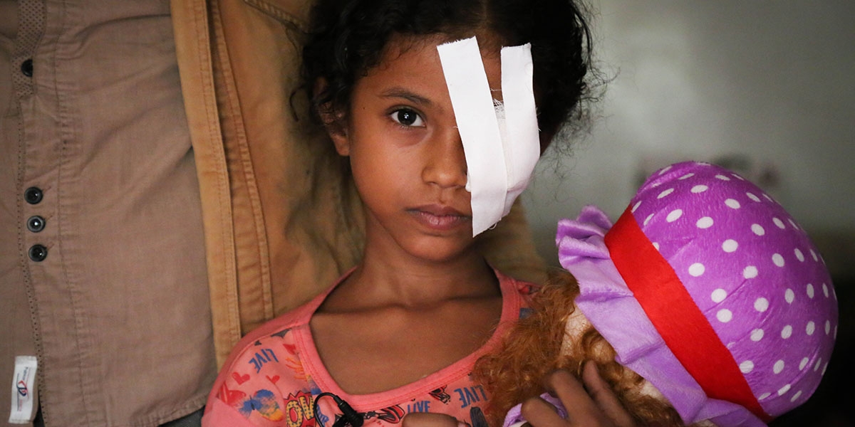 In Yemen, a girl wears a white bandage covering her wounded eye and holds a doll in her hands. 