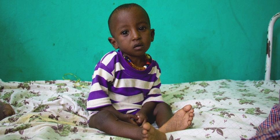 This is two-year-old boy is being treated for severe acute malnutrition in Ethiopia. He started getting sick two months back, but his health is getting worse. Photo Credit: Stuart J. Sia/Save the Children 2016.