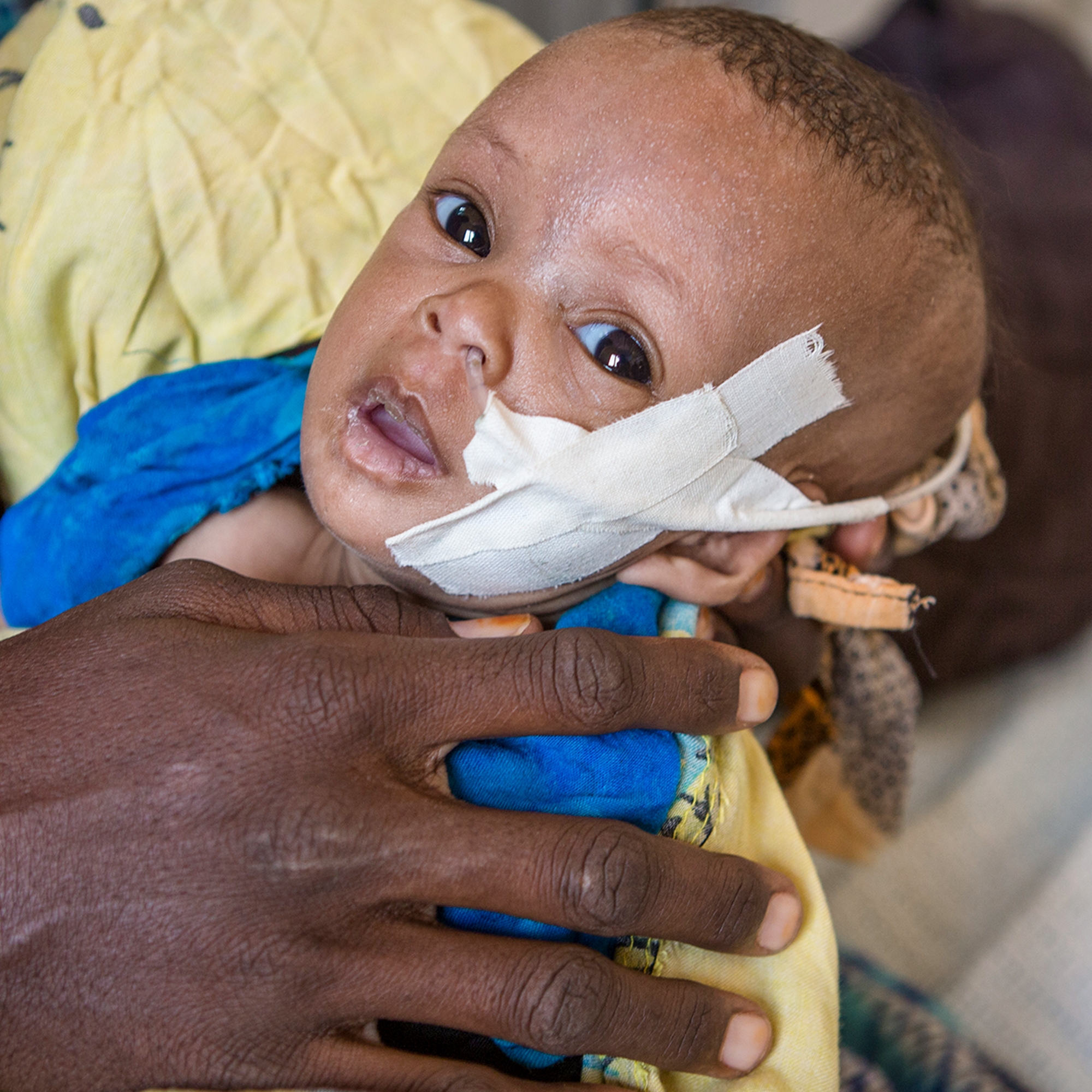 A 3-month-old child – cradled in her mother’s hands – receives treatment for severe pneumonia, malnutrition and dehydration at a Save the Children-supported hospital in Kenya. Photo credit: Jonathan Hyams/Save the Children, July 2017. 