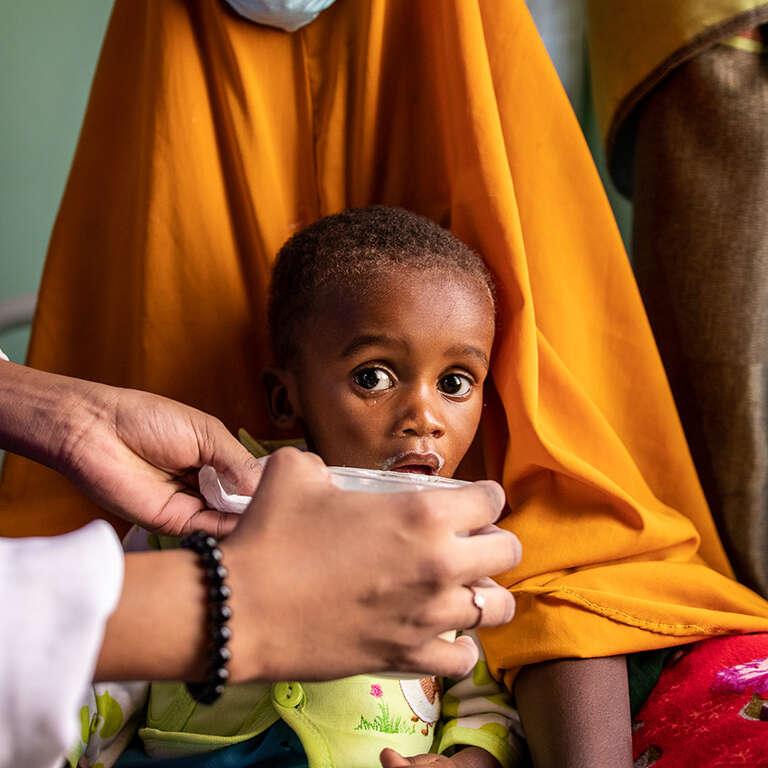 In Somalia, a baby receives treatment for malnutrition.