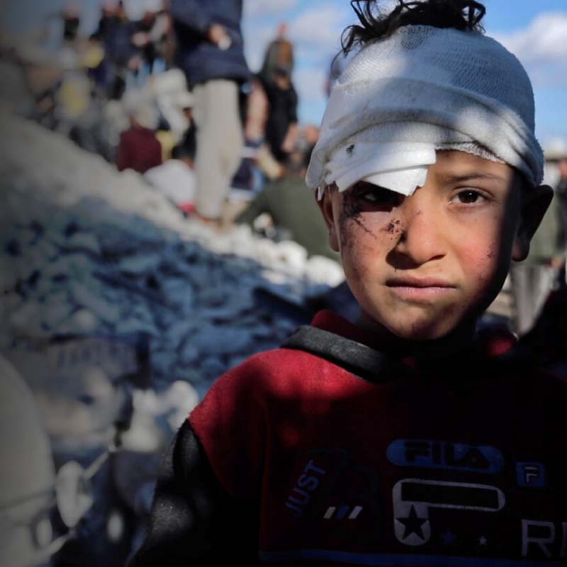 A Syrian boy whose head is bandaged stands amidst a group of people impacted by deadly conflict. 