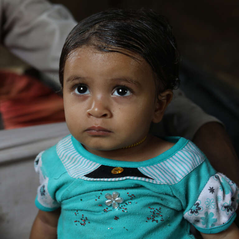 A baby girl sits near her father in Yemen where she is receiving medical treatment for malnutrition. 