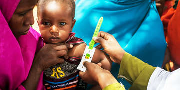 A health worker measures a baby’s arm using a MUAC (mid-upper arm circumference) armband at the Adado hospital, in Somalia. The armband helps health workers know if a child is suffering from malnutrition. The head of the hospital acknowledged that the work carried out Photo credit: Mustafa Saeed / Save the Children, July 2017.  