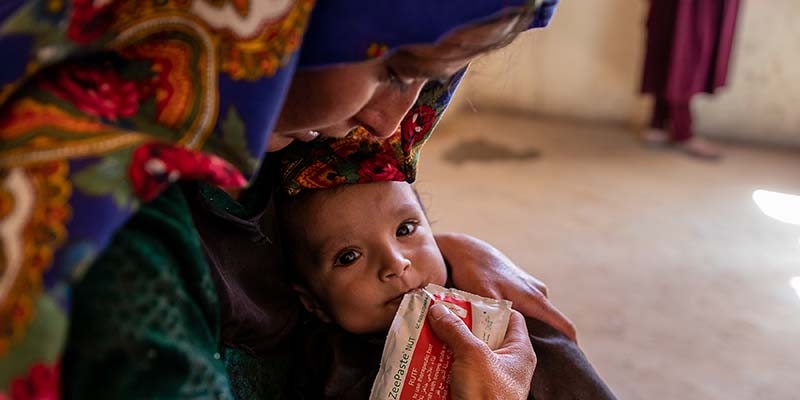 In Afghanistan, a baby suffering from severe acute malnutrition rests in the arms of a woman.
