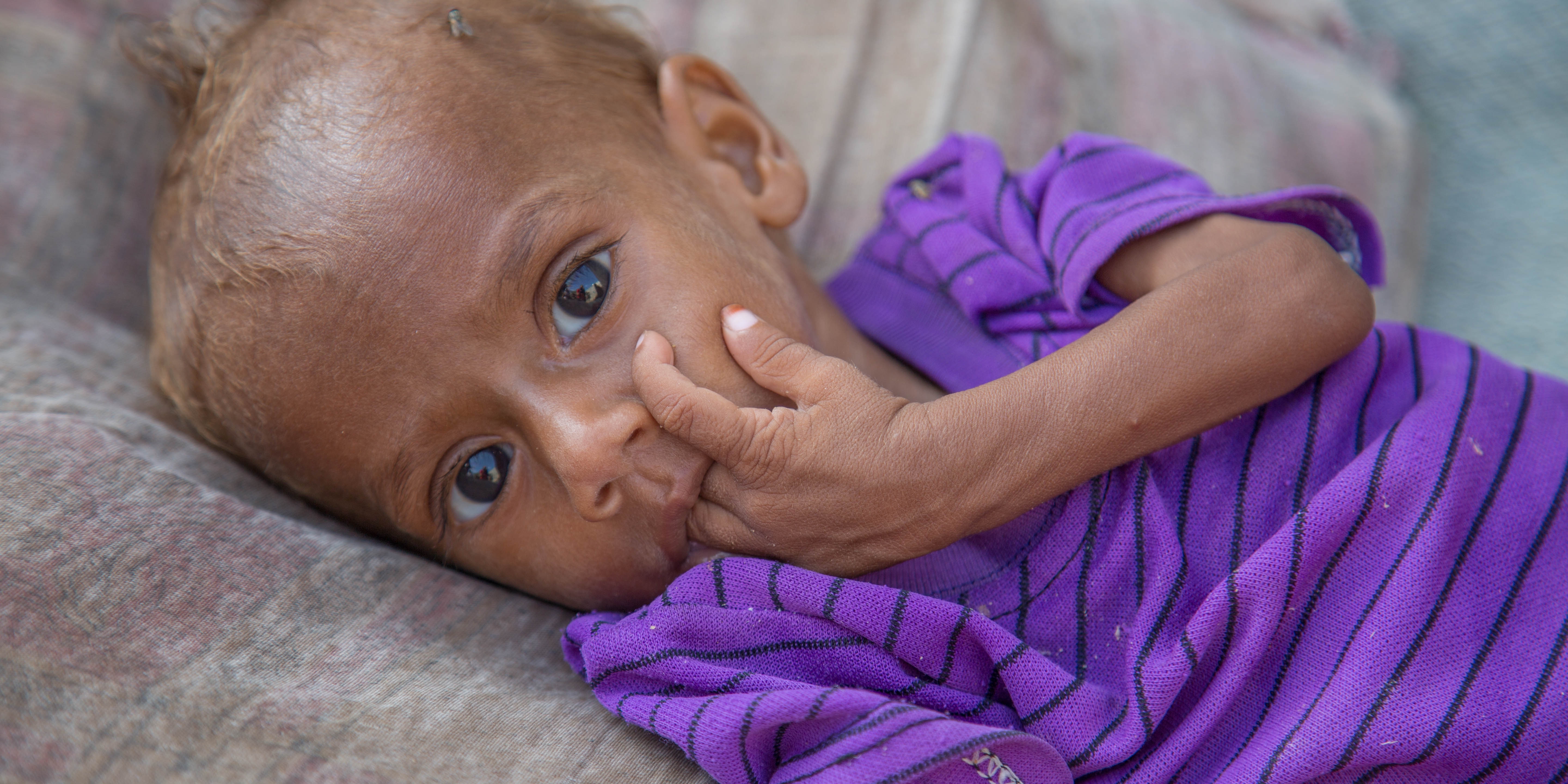 Nusair*, 13 months old, lies on a bed in his house in Hodeidah, Yemen. Severely malnourished, the baby boy was treated for malnutrition in a Save the Children supported clinic. Credit: Mohammed Awadh / Save the Children, Oct 2018