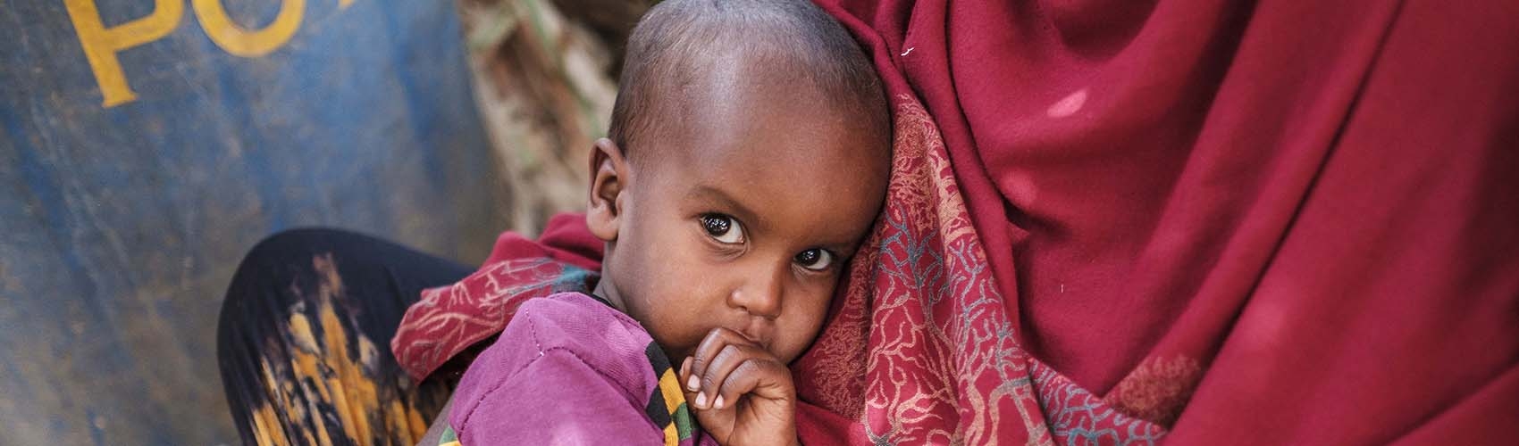 A five-month old baby boy rests on his mother's lap while receiving treatment in Ethiopia for malnutrition.