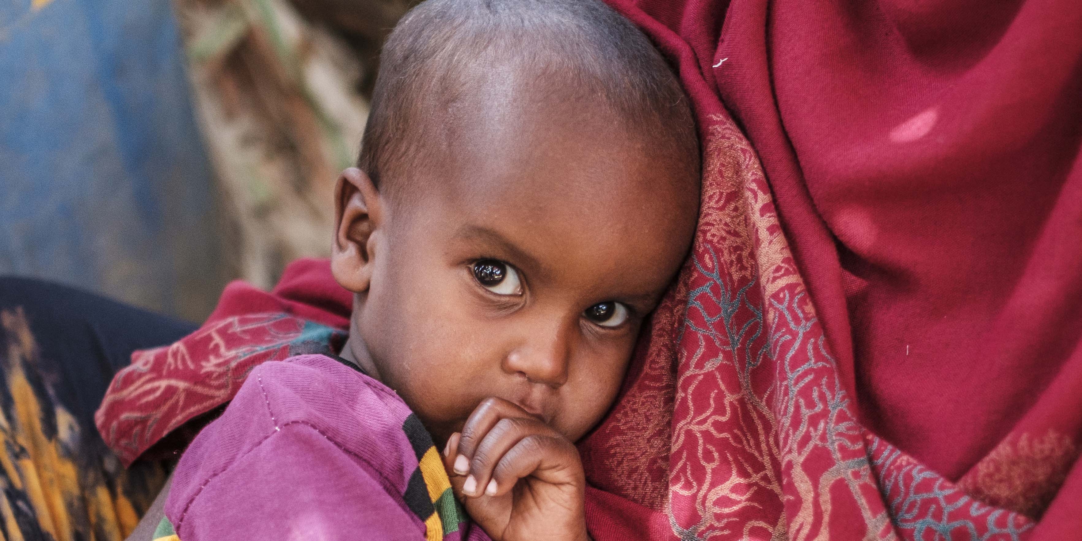 A small child who had been diagnosed with Severe Acute Malnutrition sits on his mother's lap in Ethiopia after receiving treatment.