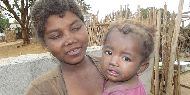  Tsaravolae , a 19, holders her of a one-year-old baby Rovasoa. 