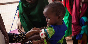 Somalia health worker checking for malnutrition in a young child.
