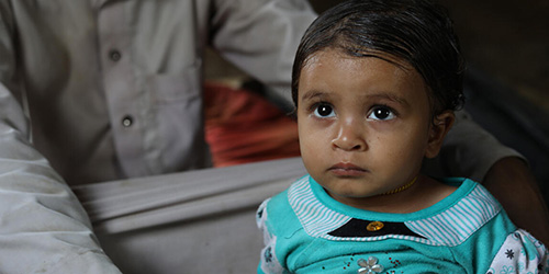 Hanan*, 1, was treated for malnutrition, Yemen.