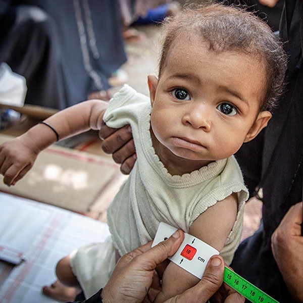 A baby in Yemen receives care from a medial worker.