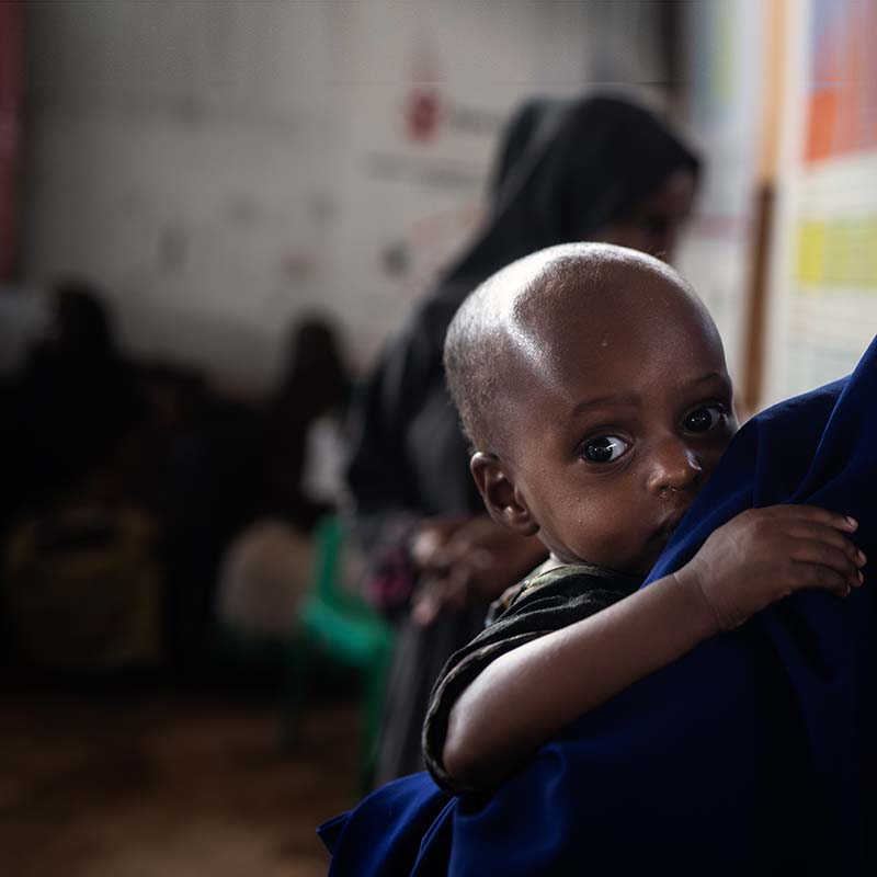 In Somalia, a mother holds her baby boy who is being treated for malnutrition.