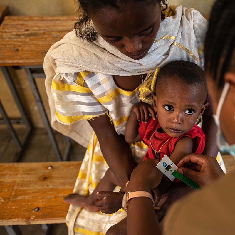 In Ethiopia, a boy wears a malnutrition band around his arm and is examined by a health care worker.