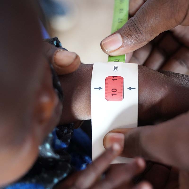 A two-year old child is measured for malnutrition using a MUAC band. 