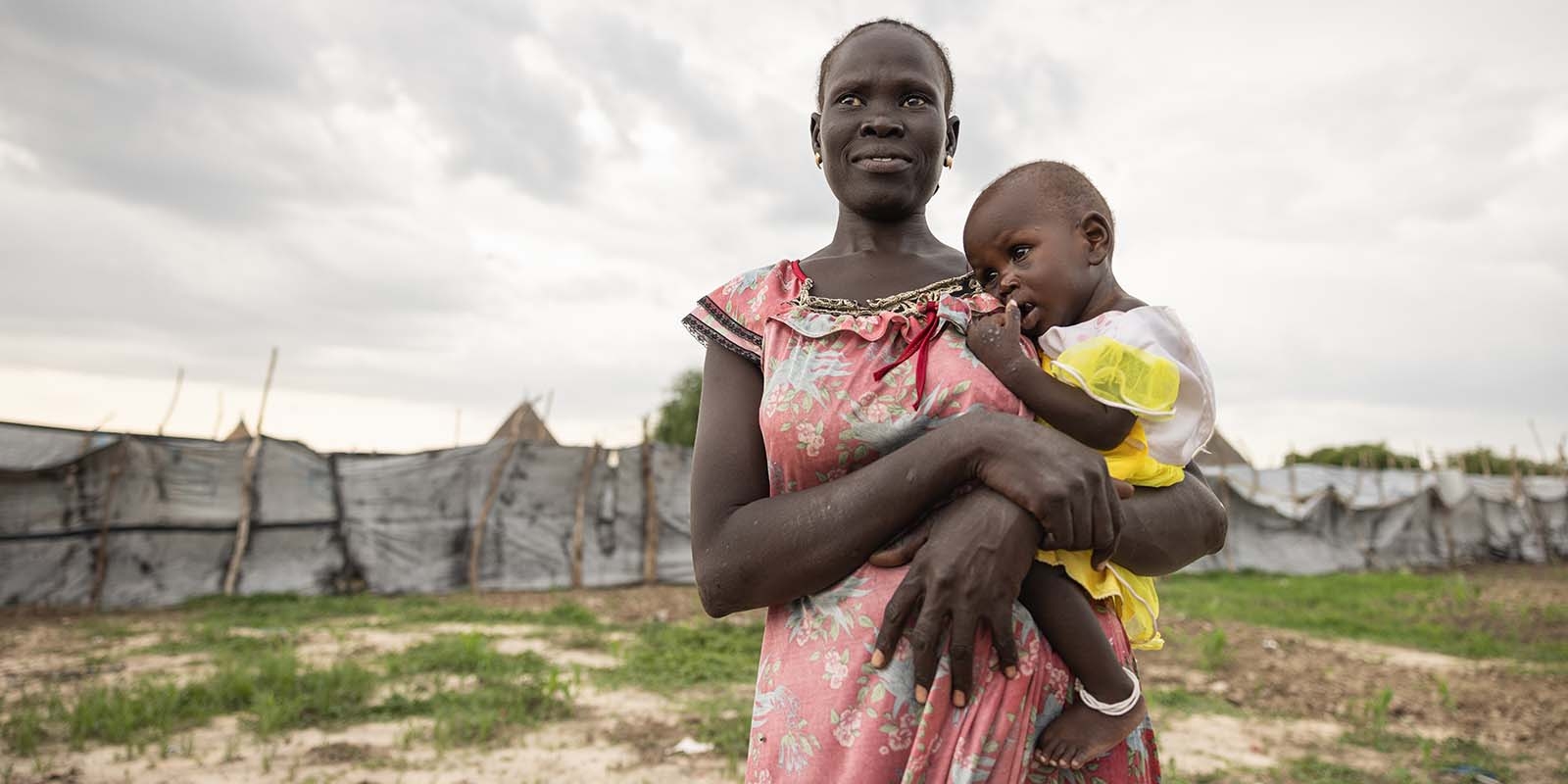 In South Sudan, a mother holds her baby in her arms who is being treated for severe acute malnutrition. 