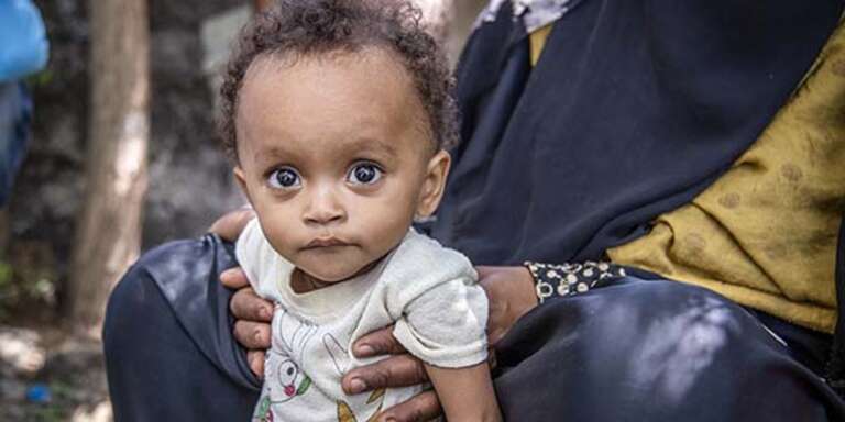 Noura*, 15 months, has her Measurement of Upper Arm Circumference (MUAC) taken by a health worker at Save the Children’s Outpatient Therapeutic Programme (OTP), in a camp for Internally Displaced People (IDP), Lahj district, Yemen, where he receives treatment for Severe Acute Malnutrition.