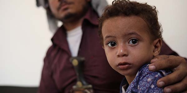 Hamdi*, 2, was brought to the health clinic supported by Save the Children by his father, Saleh*, 22, where he received urgent treatment for malnutrition. 