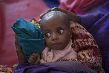 Somalia Baby