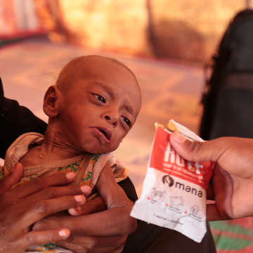 8 month baby Nabil* suffers from Severe Acute Malnutrition. He lives with his family in a tent in an IDP camp in Aden. His family moved from Alhudaidah due to the fighting. Photo credit: Save the Children, November 2018.