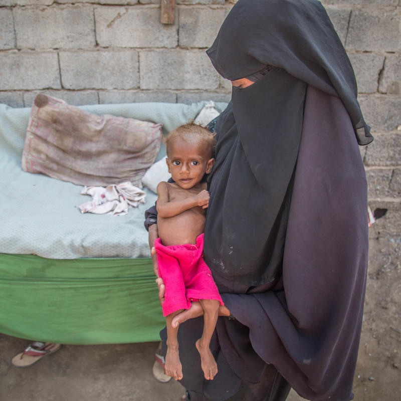 Nusair* (13 months old), with his mother Suad* in Hodeidah, Yemen. Their family was displaced from their home when conflict in their neighborhood made it unsafe to stay. Save the Children is helping Nusair* recover from malnutrition for the second time in three months.
