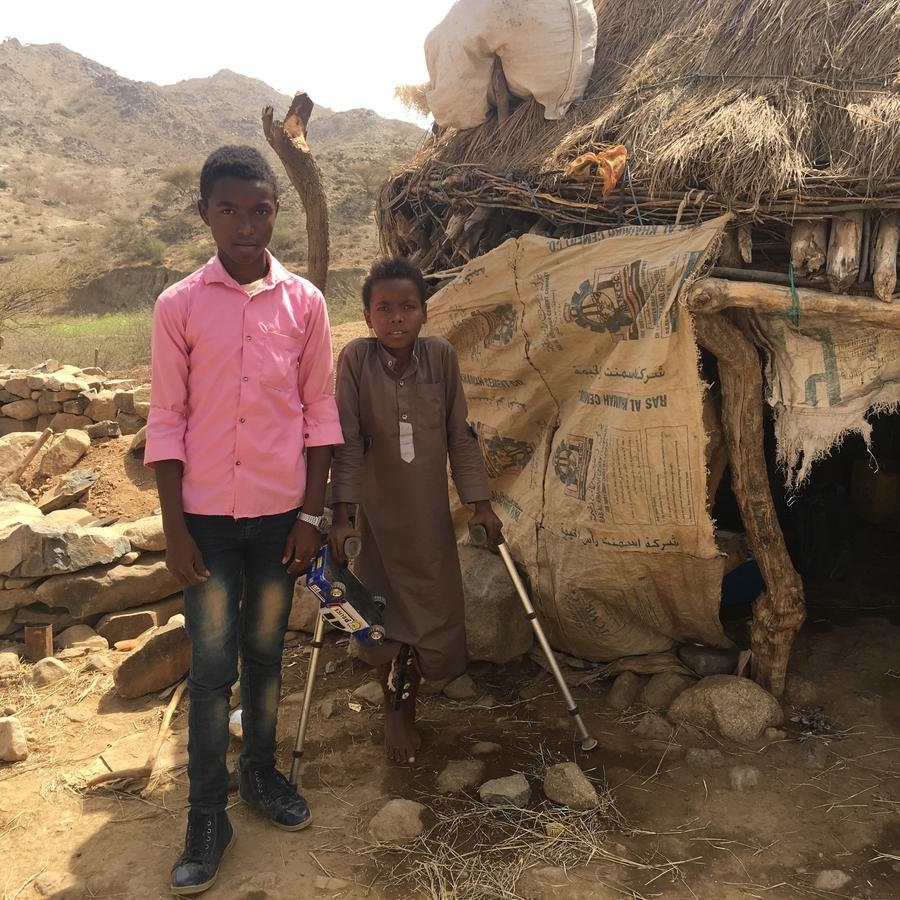 Two Yemeni boys stand outside their thatched-roof home. The younger boy has pins in his leg to help him heal from injuries he sustained during an airstrike. He stands with the help of crutches, clutching his most prized possession, a toy truck. Photo credit: Majed Nadhem/ Save the Children. 2019.