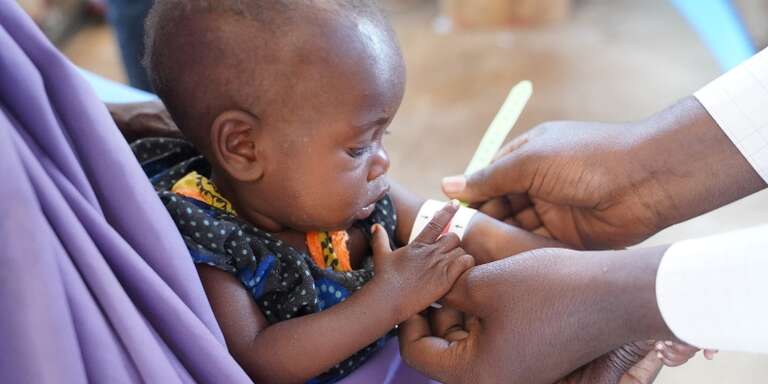 Nine month old Fawzia being treated for malnutrition at a health facility run by Save the Children